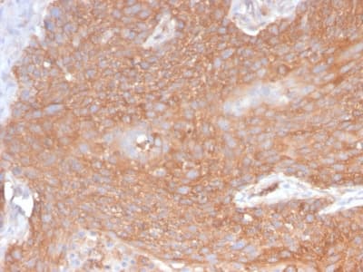 Recombinant Monoclonal Rabbit anti-Human SPTBN2 Antibody (clone SPTBN2/2894R, aa356-475, IHC, WB)