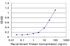Monoclonal Mouse anti-Human EXOSC10 Antibody (clone 1E6, WB)