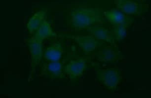 NEFM / NF-M Antibody (clone OTI2C4, Carrier-free)