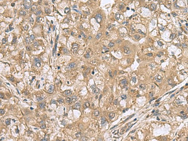PAPSS2 Antibody