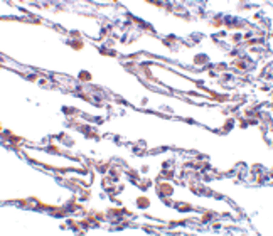 TRAF3IP2 / ACT1 Antibody