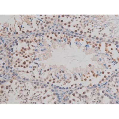 Polyclonal Rabbit anti-Human GFAP Antibody (phospho-Ser38, IHC, IF, WB)