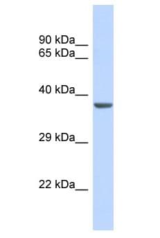 Polyclonal Rabbit anti-Human KCNJ11 / Kir6.2 Antibody (aa121-170, WB)