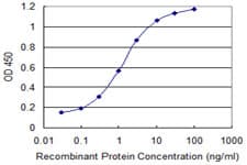 FDX1 / ADX Antibody (clone 1E7)