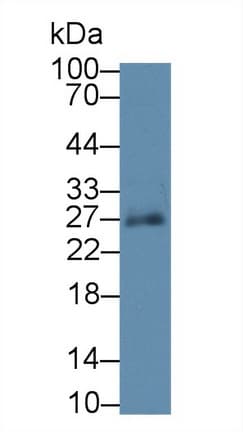 SPRY3 / Sprouty 3 Antibody (aa91-288)