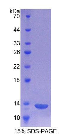 Human CHRNA1 Protein (Recombinant His-T7)