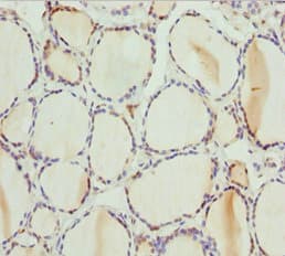 PSPH Antibody