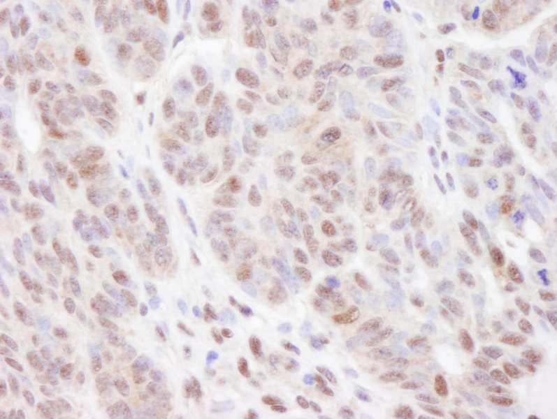 Polyclonal Rabbit anti-Human VCP Antibody (aa750-C-term, IHC, WB)