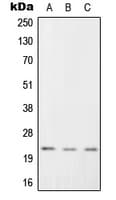 RGS1 Antibody (Internal)