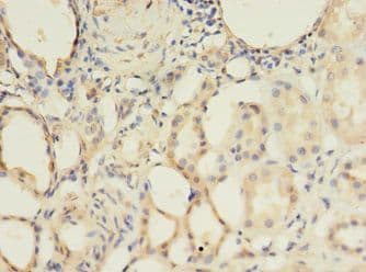 ALK3 / BMPR1A Antibody (aa177-532)