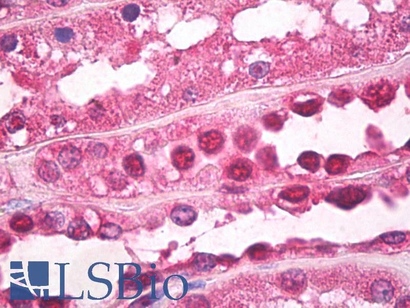 IHC-plus™ Polyclonal Rabbit anti-Bovine Ubiquitin Antibody (IHC, IF, WB)