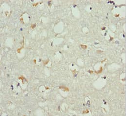 EF1B / EEF1B2 Antibody
