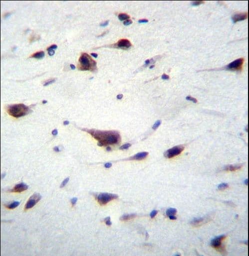 PREX1 / P-REX1 Antibody (aa1134-1163)