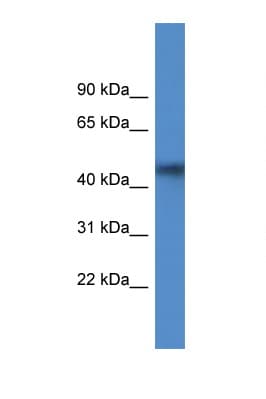 AGPAT4 Antibody (aa140-189)