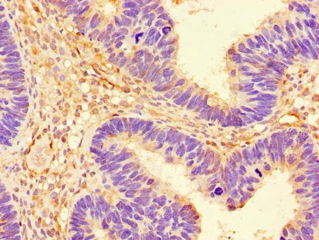 PRKAA1 / AMPK Alpha 1 Antibody