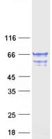 Human TCP11L2 Protein (Recombinant Myc-DDK (Flag))