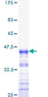 Human Neurofibromin / NF1 Protein (Recombinant GST, N-terminus)