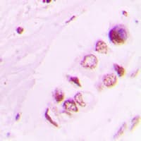 Histone H3 Antibody (Acetyl-Lys9)