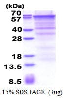 Human CD105 Protein (Recombinant His)