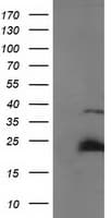 Monoclonal Mouse anti-Human SSX1 Antibody (clone OTI2F8, IHC, IF, WB)