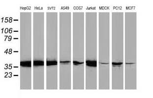 MAPRE2 / EB2 Antibody (clone OTI1A3)