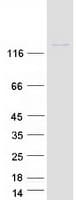 Human PSD3 Protein (Recombinant Myc-DDK (Flag))