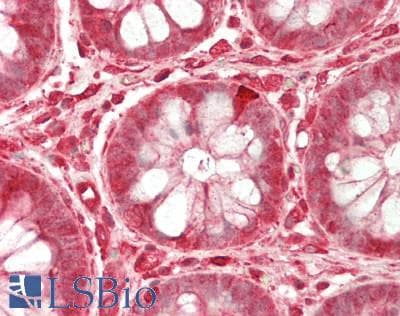 IHC-plus™ OSBPL2 Antibody (aa418-480)