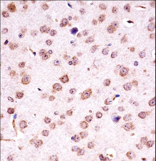 CHUK / IKKA / IKK Alpha Antibody (aa551-578)
