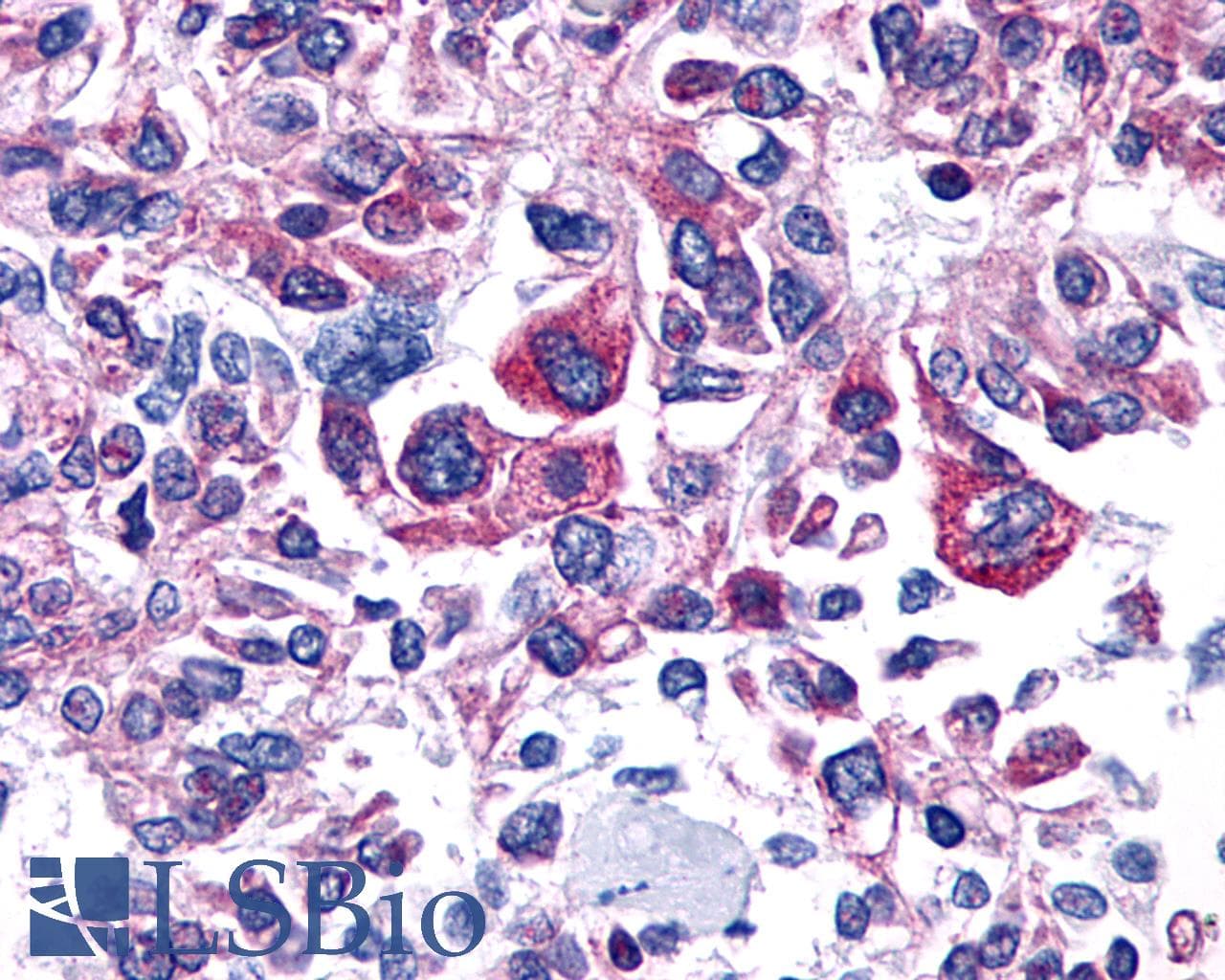 PathPlus™ Polyclonal Rabbit anti-Human PTGER4 / EP4 Antibody (C-Terminus, IHC)
