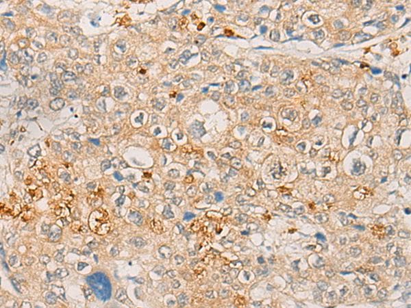 FBXO32 / Fbx32 Antibody