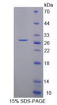 Mouse PCDHA1 Protein (Recombinant His-T7)