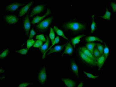 IHC-plus™ CAST / Calpastatin Antibody (aa1-667)