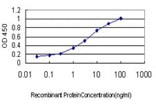 ABCC6 / MRP6 Antibody (clone 1E6)