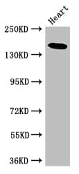 IHC-plus™ MYBPC3 / MYBP-C Antibody (aa1-328)