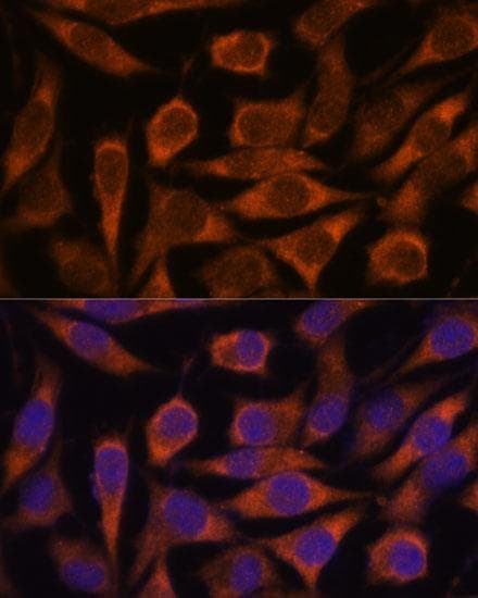 ME3 Antibody