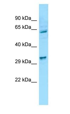 Polyclonal Rabbit anti-Human PIG8 / EI24 Antibody (aa23-72, WB)