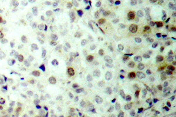 Polyclonal Rabbit anti-Human CDK1 / CDC2 Antibody (phospho-Thr161, IHC, WB)