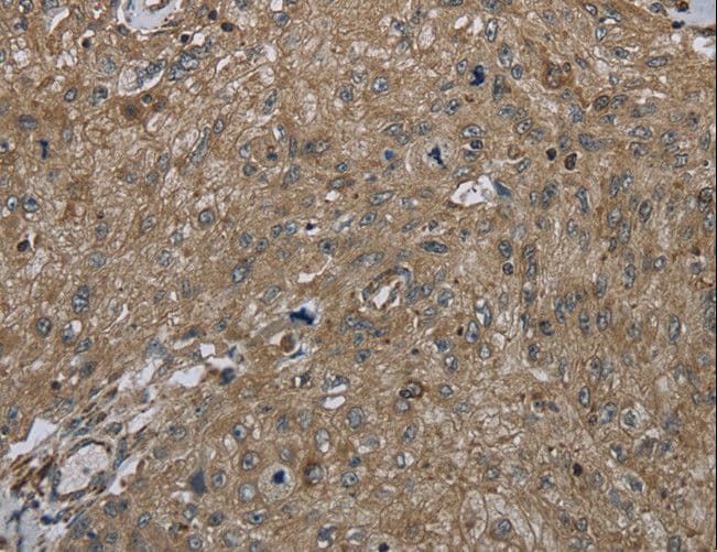 Polyclonal Rabbit anti-Human CLPS / Colipase Antibody (IHC)