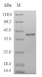 Human C8orf4 Protein (Recombinant GST, N-terminus)