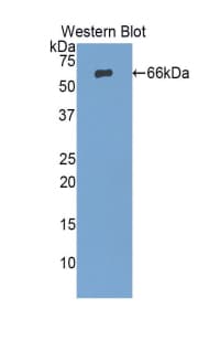 PRSS8 / Prostasin Antibody (aa30-339)