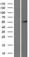 DKC1 / Dyskerin Protein (Over-Expression Lysate Myc-DDK (Flag))