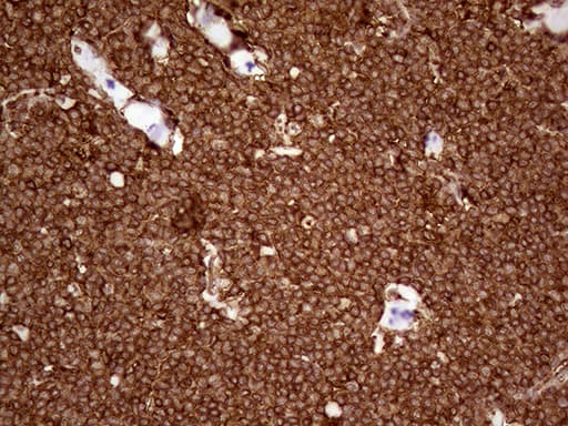 IQGAP1 Antibody (aa464-609, clone OTI7F5, Carrier-free)