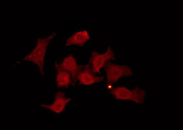 GRK6 Antibody