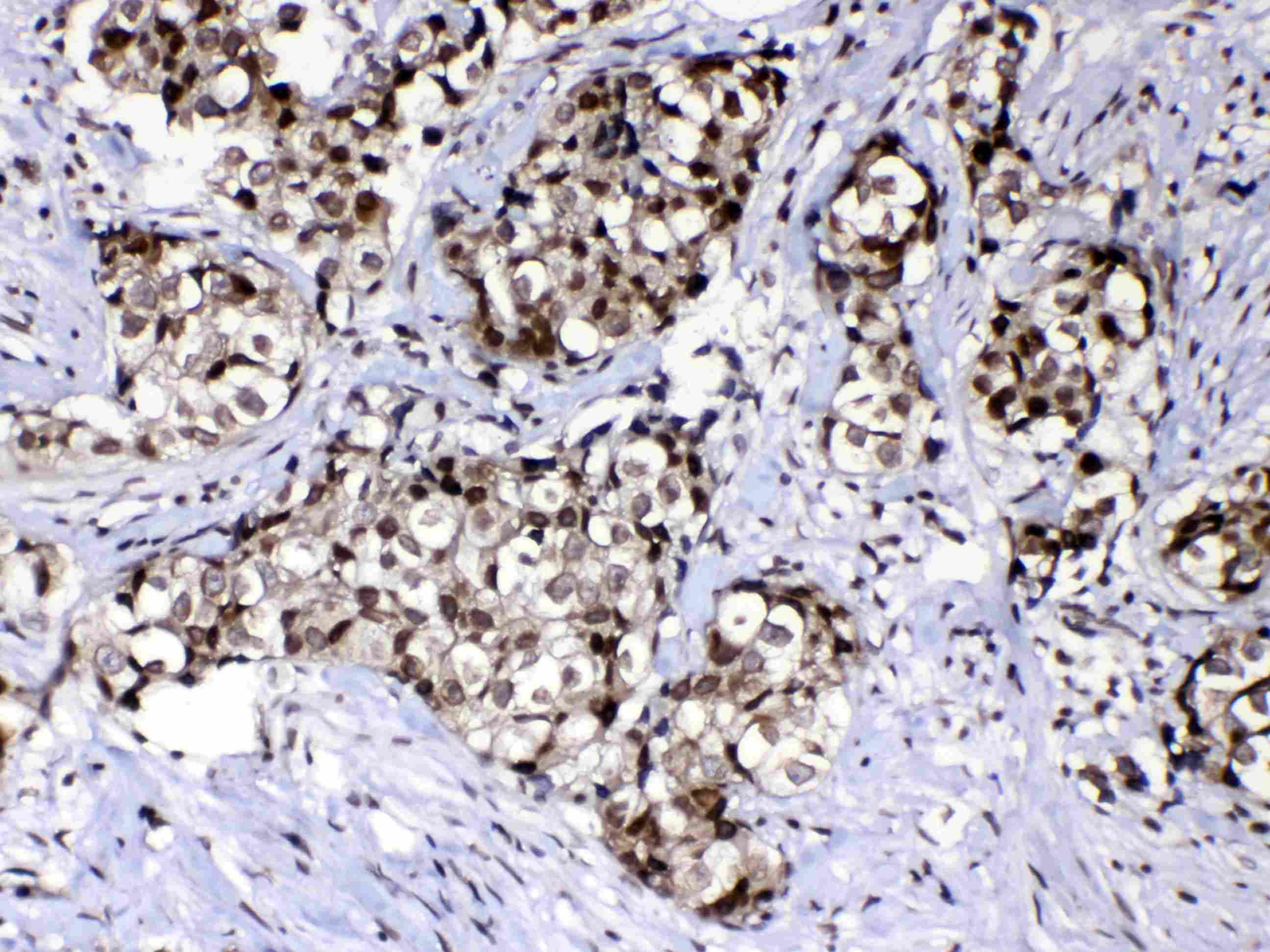 RAN Antibody