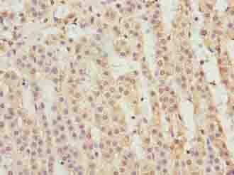 IHC-plus™ Polyclonal Rabbit anti-Human PPP1R14A / CPI-17 Antibody (IHC)