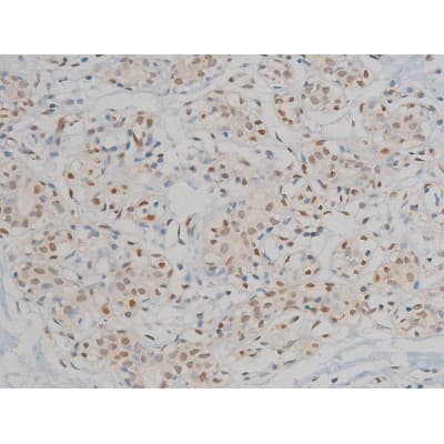 MAPK3 / ERK1 Antibody (phospho-Tyr204,pThr202)