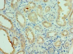 NEK2 Antibody (aa1-135)