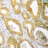 UBCH10 / UBE2C Antibody