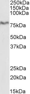 IHC-plus™ XPNPEP1 / Aminopeptidase P Antibody (aa655-666)