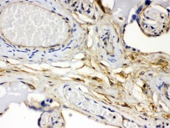 FGF1 / Acidic FGF Antibody